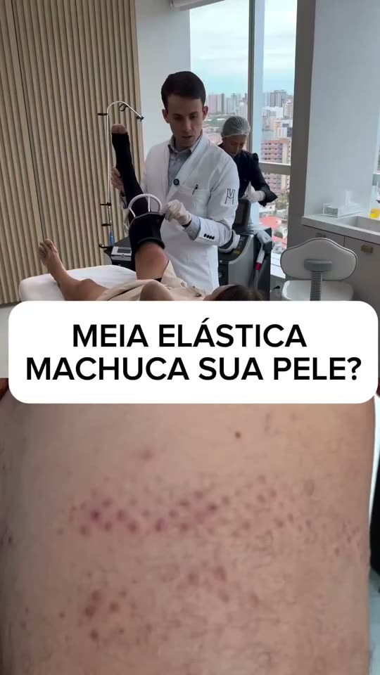Meia de compressão irrita a pele? O silicone e como evitar