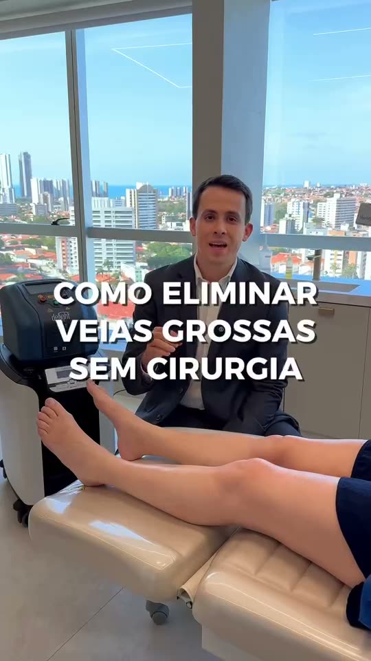 Veias grossas nas pernas: como tratar sem cirurgia